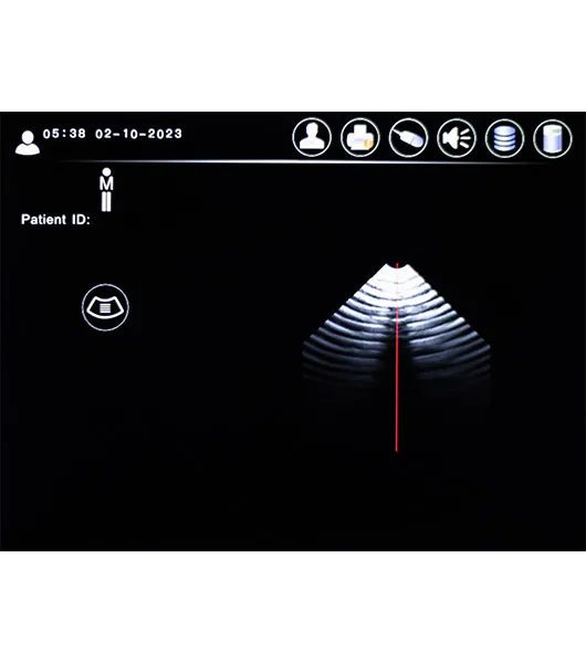 Medacure PBS5.1 | Professional Bladder Scanner - Bladder Scanners - Stretchers R Us