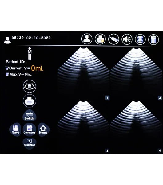 Medacure PBS5.1 | Professional Bladder Scanner - Bladder Scanners - Stretchers R Us